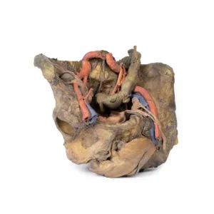 3D Printed Female Pelvis Deep Dissection