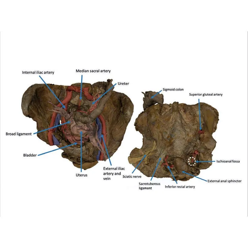 3D Printed Female Pelvis Deep Dissection