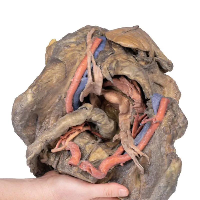 3D Printed Female Pelvis Deep Dissection