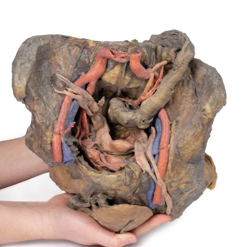 3D Printed Female Pelvis Deep Dissection