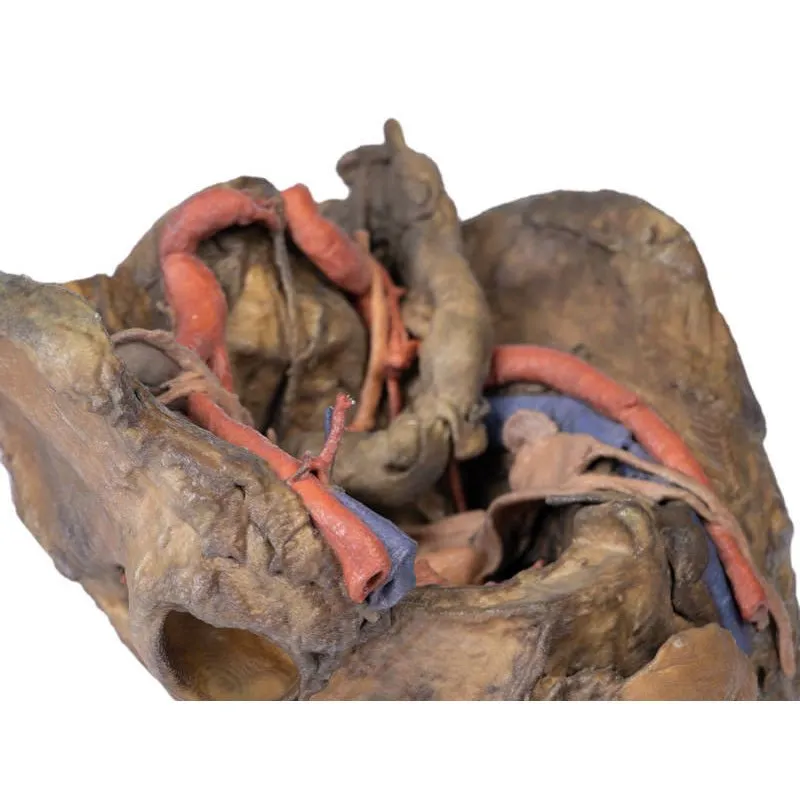 3D Printed Female Pelvis Deep Dissection